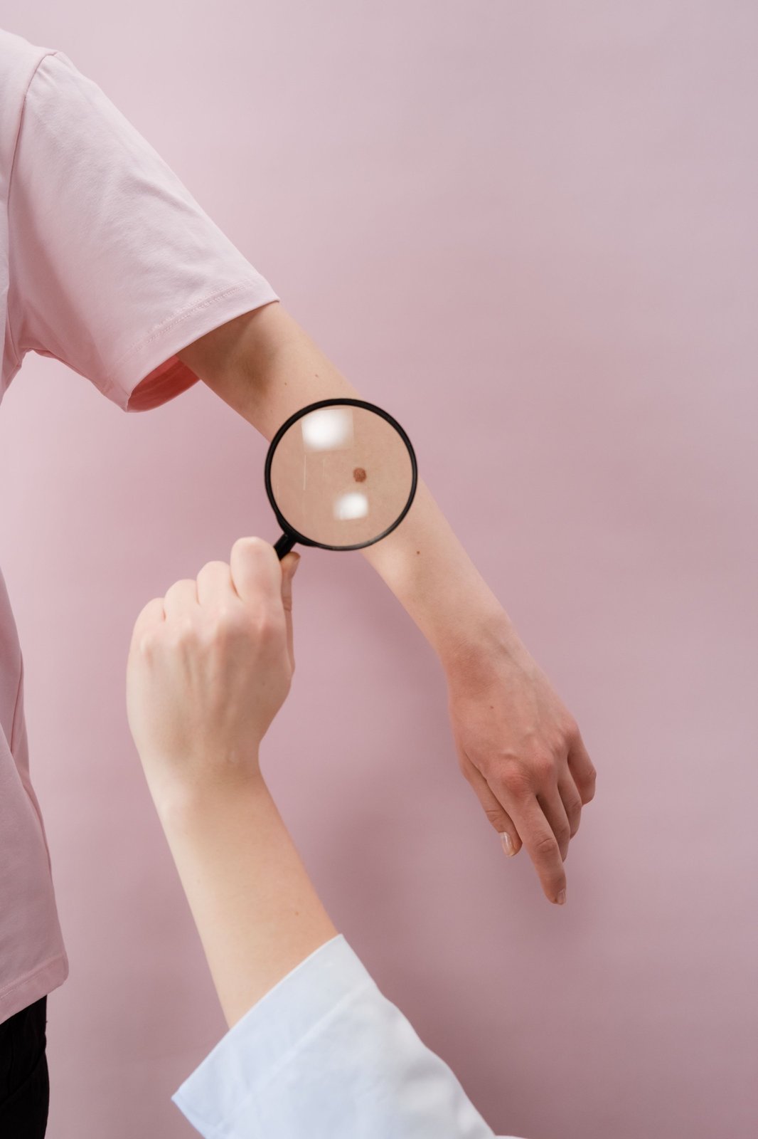 Advanced laser skin treatment session at SKIN THEORY clinic