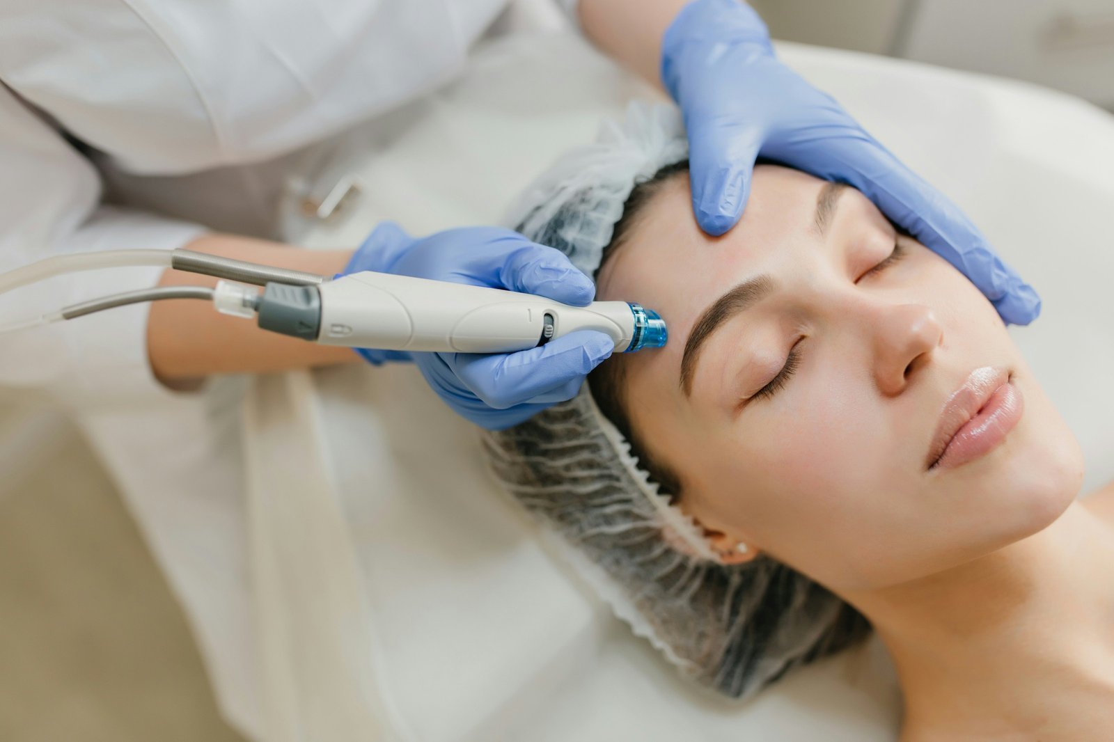 Microdermabrasion treatment on the forehead (sample photo)